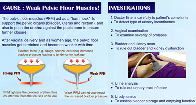 Is it a urinary tract infection or pelvic floor dysfunction